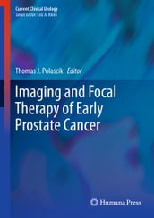 Imaging and Focal Therapy of Early Prostate Cancer