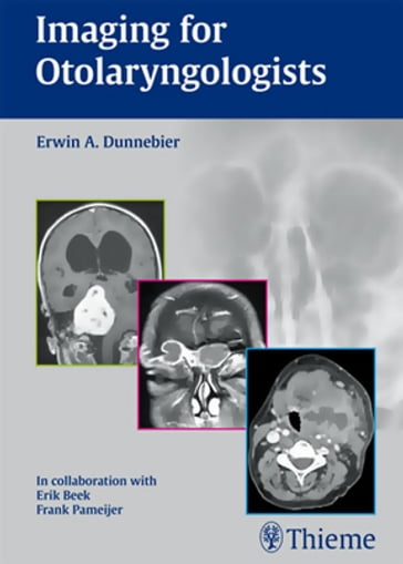 Imaging for Otolaryngologists - Erwin A. Dunnebier