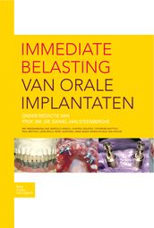 Immediate belasting van orale implantaten