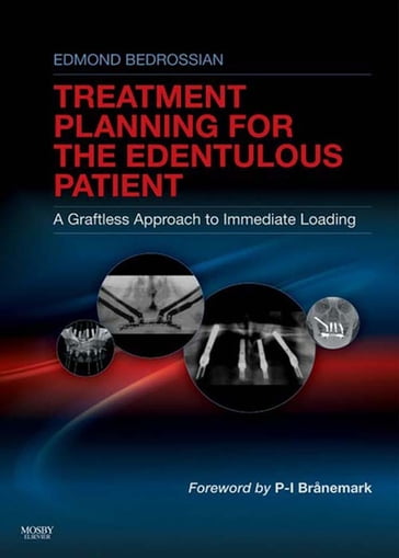 Implant Treatment Planning for the Edentulous Patient - Edmond Bedrossian