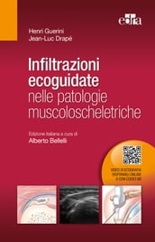 Infiltrazioni ecoguidate nelle patologie muscoloscheletriche