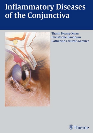 Inflammatory Diseases of the Conjuctiva - Thanh Hoang-Xuan - Christophe Baudouin - Catherine Creuzot-Garcher