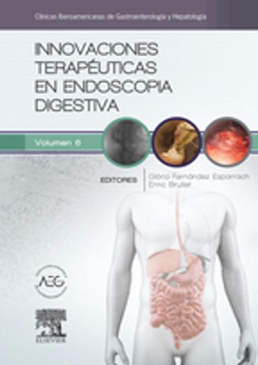 Innovaciones terapéuticas en endoscopia digestiva - Antoni Castells Garangou - Henri Cohen