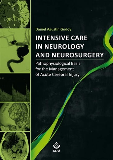 Intensive Care in Neurology and Neurosurgery - Daniel Agustin Godoy - Daniel Agustín - Godoy