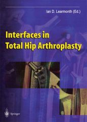 Interfaces in Total Hip Arthroplasty