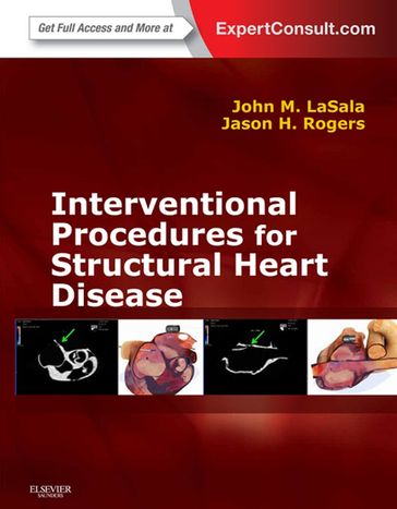 Interventional Procedures for Adult Structural Heart Disease E-Book - MD  PhD John M Lasala - MD  FACC  FSCAI Jason H. Rogers