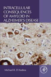 Intracellular Consequences of Amyloid in Alzheimer s Disease