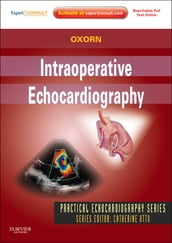 Intraoperative Echocardiography- E-BOOK