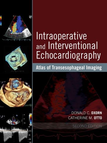 Intraoperative and Interventional Echocardiography - MD  CM  FRCPC  FACC  DNBE Donald Oxorn - MD Catherine M. Otto