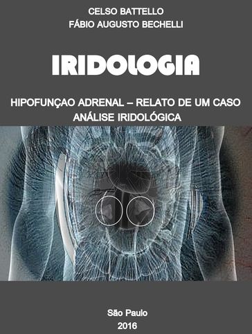 Iridologia - Hipofunção Adrenal - CELSO BATTELLO - Fabio Augusto Bechelli