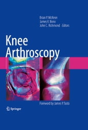 Knee Arthroscopy