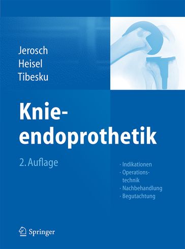 Knieendoprothetik - Carsten O. Tibesku - Georg Matziolis - Jorg Jerosch - Jurgen Heisel