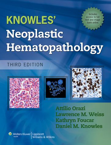 Knowles Neoplastic Hematopathology - Attilio Orazi - Daniel Knowles - Kathy Foucar - Lawrence M. Weiss