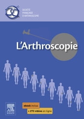 L arthroscopie