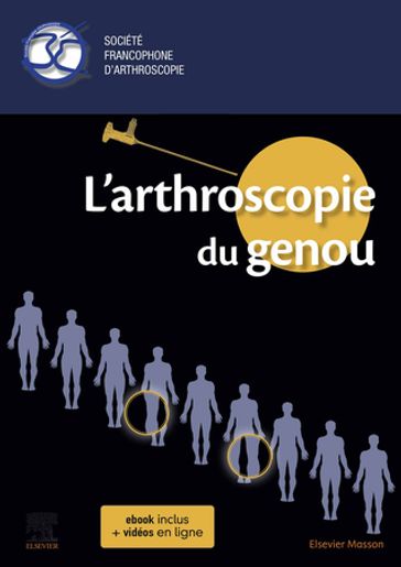 L'arthroscopie du genou - Société Francophone D