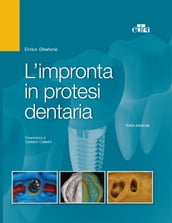 L impronta in protesi dentaria