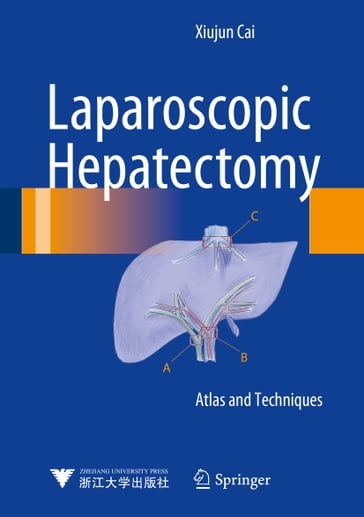 Laparoscopic Hepatectomy - Xiujun Cai