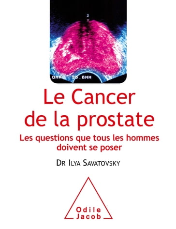 Le Cancer de la prostate - Ilya Savatovsky