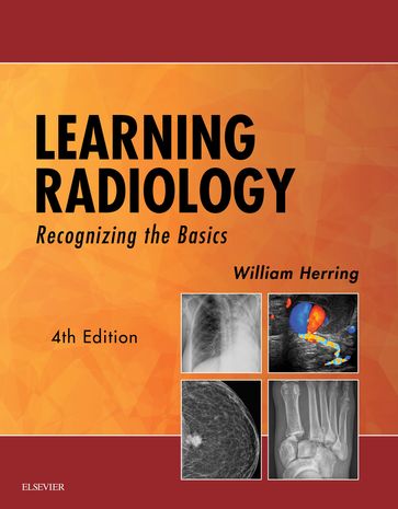 Learning Radiology - William Herring - MD - FACR