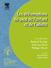 Les déformations du pied de l enfant et de l adulte