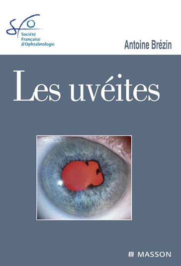 Les uvéites - Antoine Brézin - Société Française d