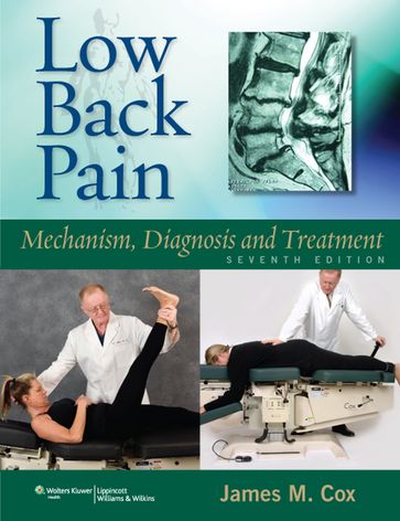 Low Back Pain - James M. Cox