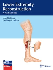 Lower Extremity Reconstruction