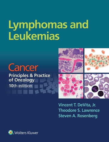 Lymphomas and Leukemias - Steven A. Rosenberg - Theodore S. Lawrence - Vincent DeVita