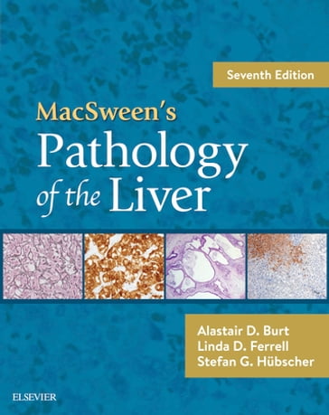 MacSween's Pathology of the Liver E-Book - MD Linda D. Ferrell - MBChB  FRCPath Stefan G. Hubscher - BSc  MBChB  MD  FRCPath  FRCPA  FRCP  FRSB  FAHMS Alastair D. Burt