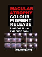 Macular Atrophy Colour Pigment Release, Photographic Evidence Book 1
