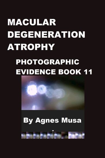 Macular Degeneration Atrophy, Photographic Evidence Book 11 - Agnes Musa