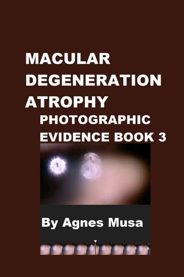 Macular Degeneration Atrophy, Photographic Evidence Book 3 - Agnes Musa