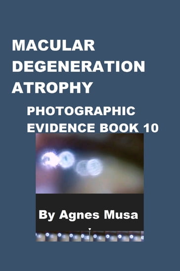 Macular Degeneration Atrophy, Photographic Evidence Book 10 - Agnes Musa