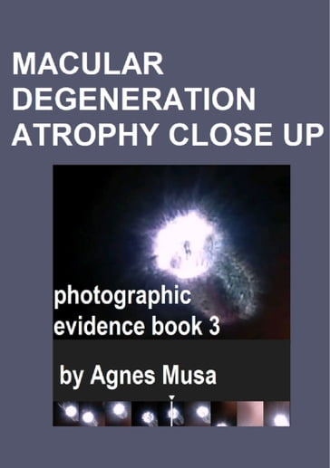 Macular Degeneration Atrophy Close Up, Photographic Evidence Book 3 - Agnes Musa