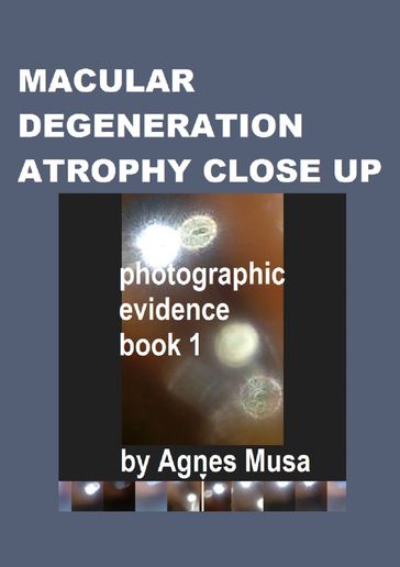 Macular Degeneration Atrophy Close Up, Photographic Evidence Book 1 - Agnes Musa