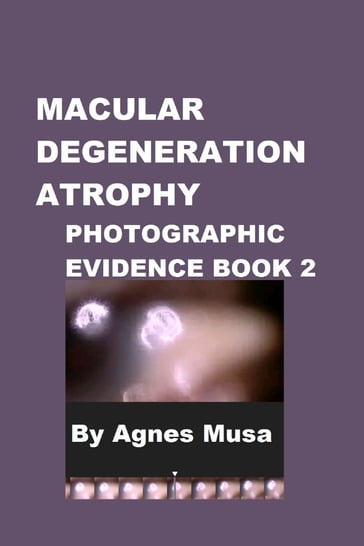 Macular Degeneration Atrophy, Photographic Evidence Book 2 - Agnes Musa