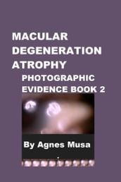 Macular Degeneration Atrophy, Photographic Evidence Book 2