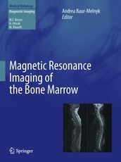 Magnetic Resonance Imaging of the Bone Marrow
