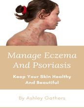 Manage Eczema And Psoriasis