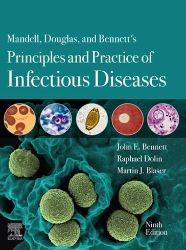 Mandell, Douglas, and Bennett's Principles and Practice of Infectious Diseases E-Book - MD John E. Bennett - MD Raphael Dolin - MD Martin J. Blaser