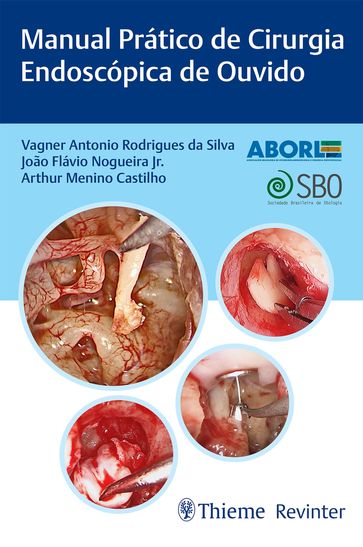 Manual Prático de Cirurgia Endoscópica de Ouvido - Vagner Antonio Rodrigues da Silva - João Flávio Nogueira Jr. - Arthur Menino Castilho