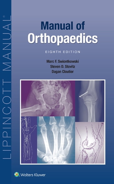 Manual of Orthopaedics - Marc F. Swiontkowski