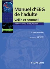 Manuel d EEG de l adulte