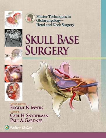 Master Techniques in Otolaryngology - Head and Neck Surgery: Skull Base Surgery - Carl Snyderman - Paul Gardner