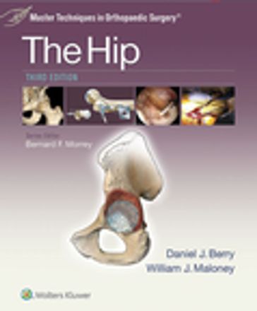 Master Techniques in Orthopaedic Surgery: The Hip - Daniel J. Berry - William Maloney