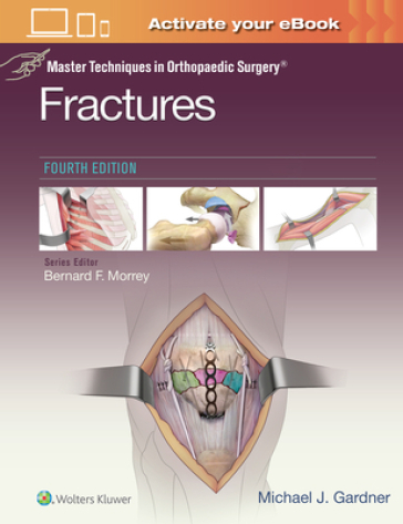 Master Techniques in Orthopaedic Surgery: Fractures - Michael J. Gardner