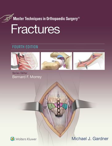 Master Techniques in Orthopaedic Surgery: Fractures - Michael J. Gardner