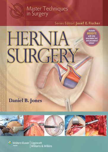 Master Techniques in Surgery: Hernia - Daniel B. Jones