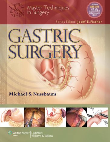 Master Techniques in Surgery: Gastric Surgery - Michael Nussbaum