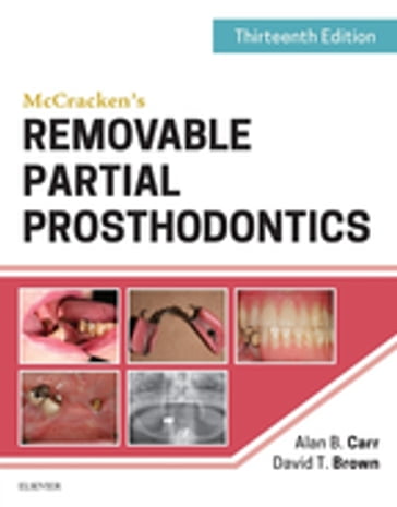 McCracken's Removable Partial Prosthodontics - DMD  MS Alan B. Carr - DDS  MS David T. Brown